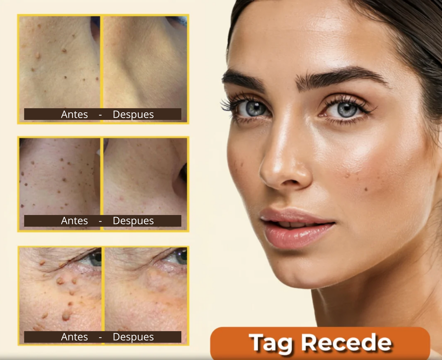 Tag Redece Elimina Verrugas y Manchas en días, sin dolor ni cicatrices 🔥👌🏻 REGALO Especial 2x1 🎁